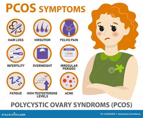 Symptoms of PCOS Infographics. Detailed Vector Infographics Stock ...