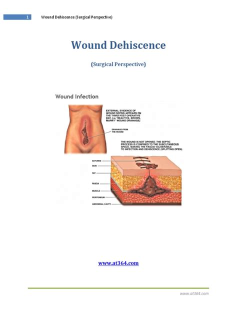 Wound Dehiscence From A Surgical Perspective | Download Free PDF ...