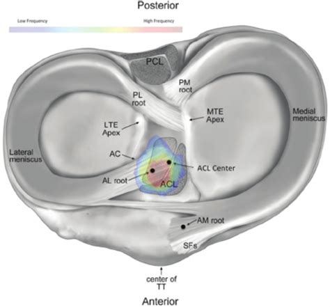 6 Meniscus Tear Types That You Need To Know About