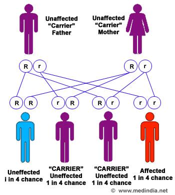 Niemann-Pick Disease, Type A; Sphingomyelinase Deficiency Disease