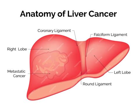 Premium Vector | Anatomy of liver cancer coronary ligament falciform ligament right lobe left ...