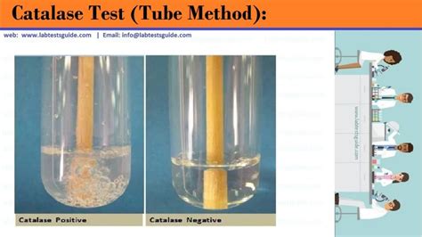 Catalase Experiment Lab Report