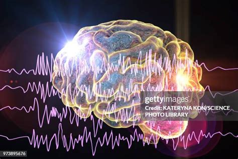 Epilepsy Brain Waves Photos and Premium High Res Pictures - Getty Images