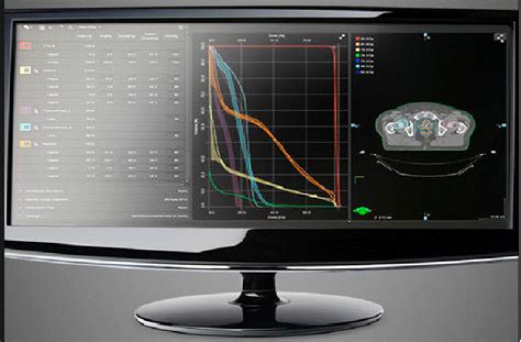 Dosimetry Services – Medical Physics Services