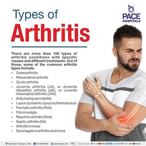 Arthritis: Symptoms, Types, Causes, Risk Factors, Complications