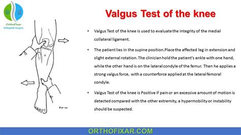 Valgus Stress Test Of The Knee | OrthoFixar 2024