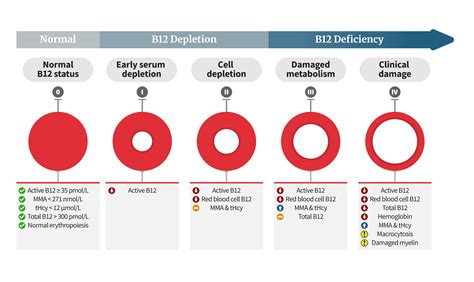 What Are The 4 Stages of B12 Deficiency? • PA Relief