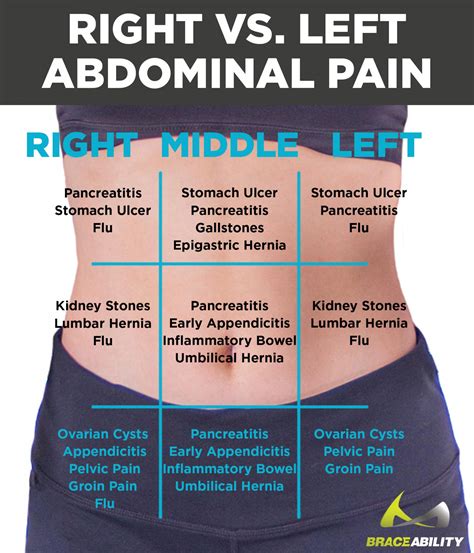 Left vs. Right Back and Abdominal Pain in Women