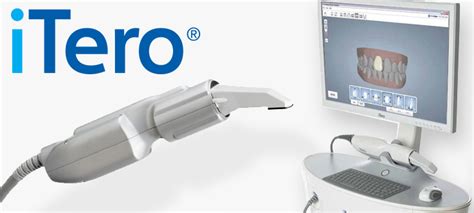 digital - iTero Element Intraoral Scanner - Iverson Dental Labs