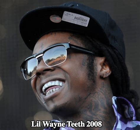 Lil Wayne Teeth - Diamonds Make His Words Precious! - Latest Plastic Surgery Gossip And News ...