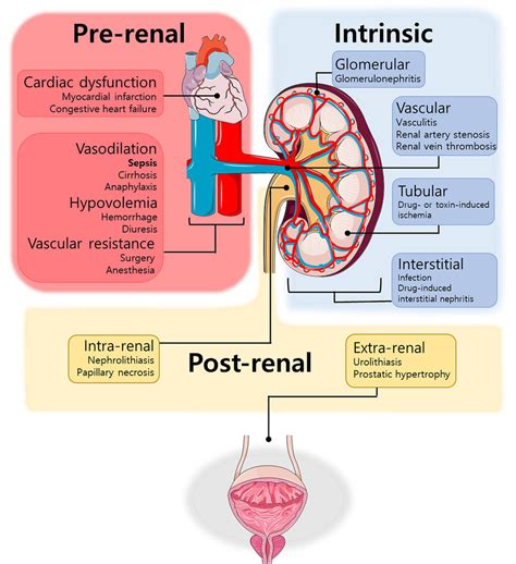 Postrenal Azotemia: Video, Anatomy Definition Osmosis, 46% OFF