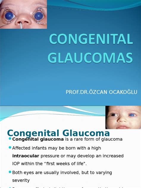 Congenital Glaucomas | PDF | Glaucoma | Ophthalmology