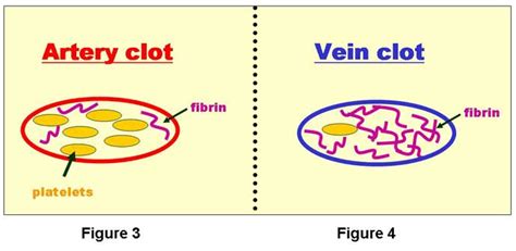 What is a blood clot? | UNC Hemophilia and Thrombosis Center