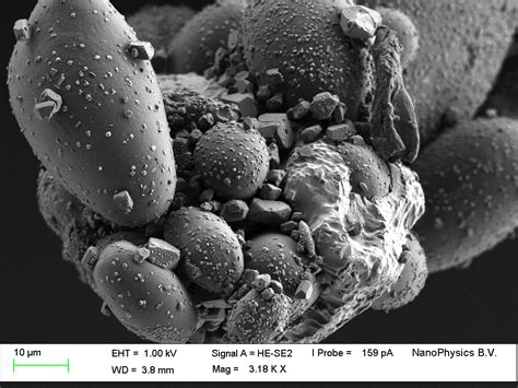 SEM-EDX - Semiconductor Intelligence