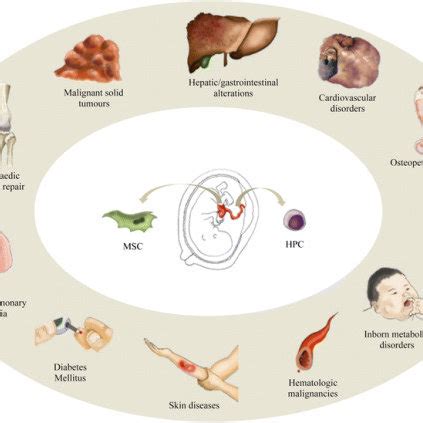 Current clinical applications of umbilical cord blood. The blood in the ...