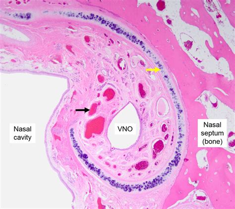 Air conduction: Nasal cavity, Paranasal sinuses, and Vomeronasal Organ – Veterinary Histology