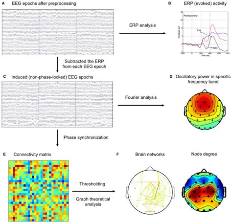 | The schematic diagram for the brain network analysis. (A)... | Download Scientific Diagram