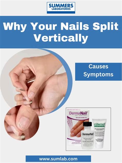 What deficiency causes nails to split vertically? | PDF | Free Download