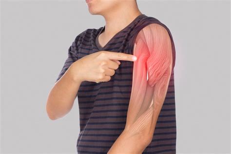 7 Causes of Pain in the Upper Arm - AICA Atlanta