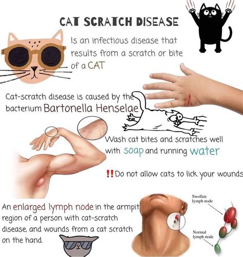 Cat Scratch Disease Neck