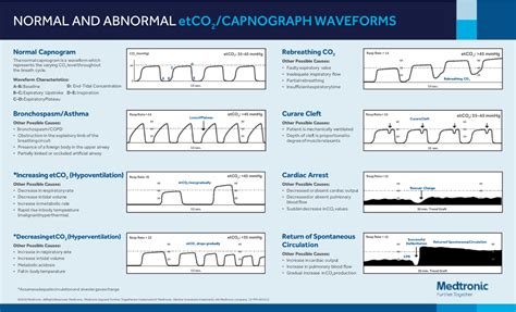 Normal and abnormal capnography waveforms infographic - CapnoAcademy CapnoAcademy