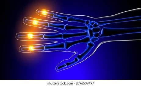 Distal Interphalangeal Joints Pain Anatomy Medical Stock Illustration 2096537497 | Shutterstock