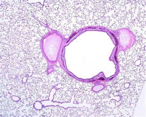 Lung Parenchyma Photograph by Jose Calvo/science Photo Library | Fine Art America