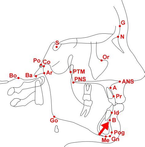 Chepalometric Analysis - B-point (Point B, Supramentale, sm) | 7lmi | Orthodontic appliances ...