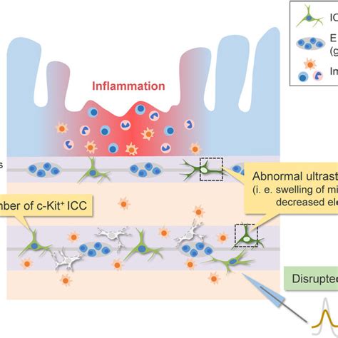 Interstitial cells of Cajal after surgical manipulation. Schematic ...