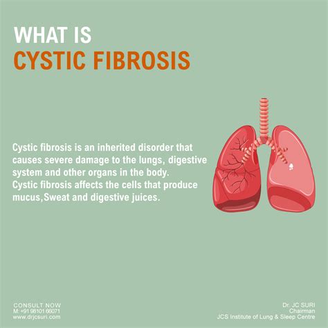 How Cystic Fibrosis Is Treated | edu.svet.gob.gt