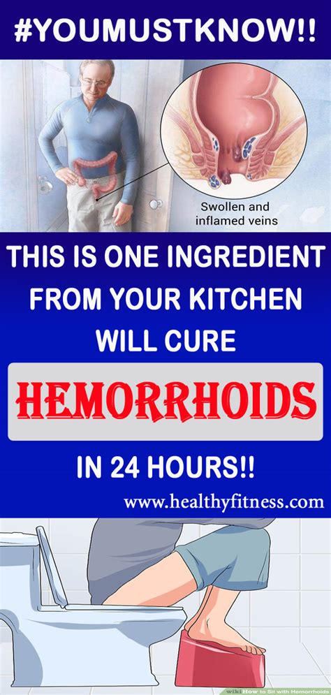 THIS SIMPLE REMEDY CAN CURE YOUR HEMORRHOIDS IN JUST 20 MINUTES ...