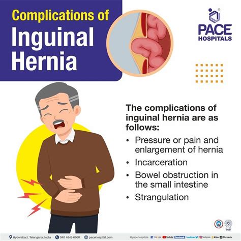 Inguinal Hernia - Signs and Symptoms, Types, Causes, Risk Factors