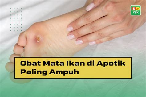 12 Obat Mata Ikan di Apotik Paling Ampuh - K24Klik