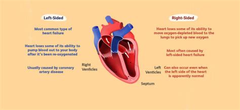 Left Sided Heart Failure, Causes, Symptoms and Treatment | Dr. Raghu