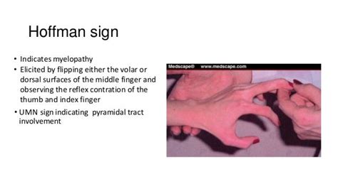 Pathophysiologic aspects, clinical manifestation a nd management of