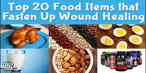 Top 20 Food Items that Fasten Up Wound Healing - Crazy Masala Food