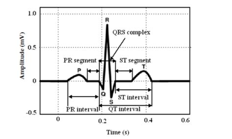 Schematic representation of normal ECG waveform [3]. | Download Scientific Diagram