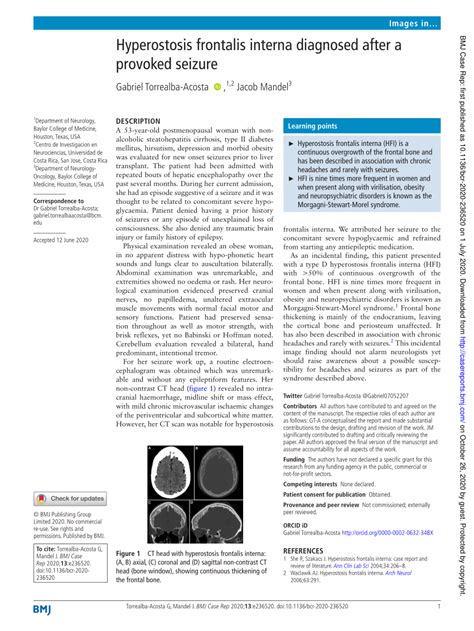 (PDF) Hyperostosis frontalis interna diagnosed after a provoked seizure