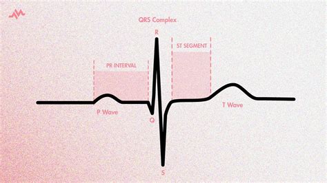 The Cardiac Cycle on an EKG (P-QRS-T Waves) - YouTube