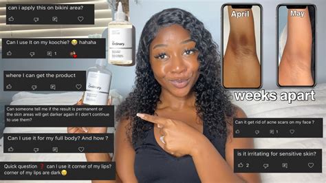 HOW TO USE GLYCOLIC ACID TONER FOR THE BEST RESULTS | answering your ...