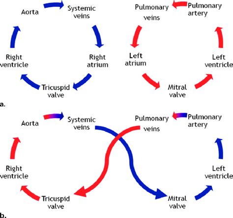 Diagrams of circulation in unrepaired D-TGA (a) and after atrial switch... | Download Scientific ...