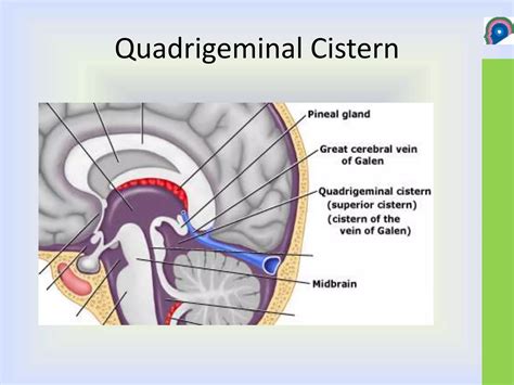 Cisterns of brain | PPT