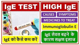 How To Reduce Ige Levels - Birthrepresentative14