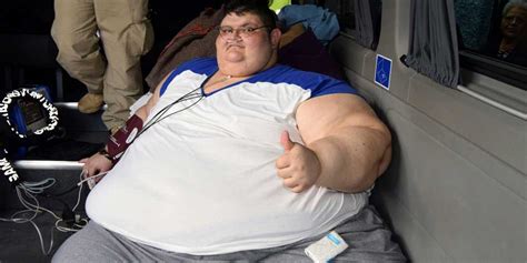 World’s heaviest man has surgery to halve weight (photo ...