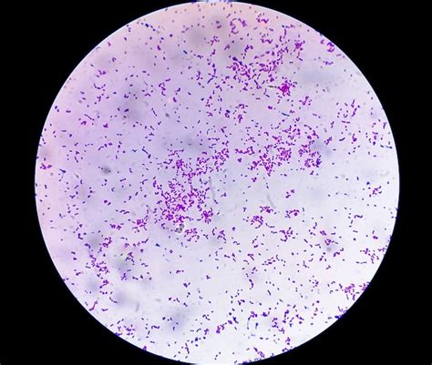 Premium Photo | Microscopic view of gram stain showing Escherichia coli or E coli bacteria