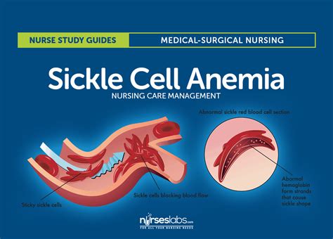 Sickle Cell Anemia Nursing Care and Management: Study Guide