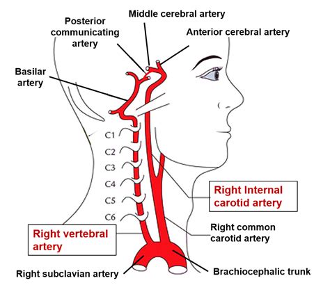 Brain – Arterial Supply – Anatomy QA