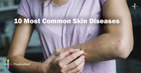 10 Most Common Skin Diseases