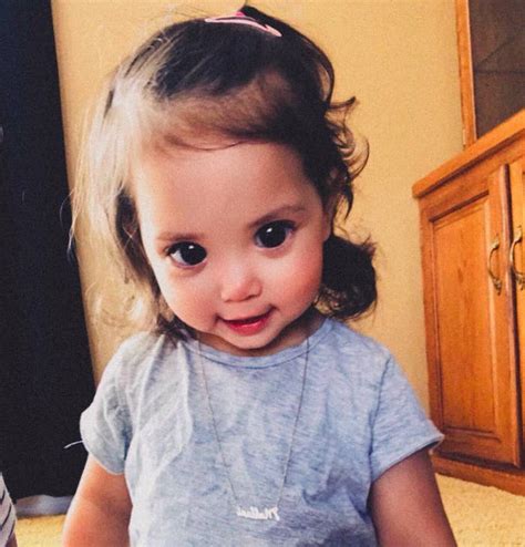 This Little Girl's Big, Beautiful Eyes Are Due To A Rare Genetic Syndrome