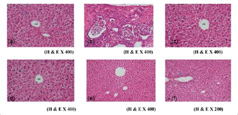 A photomicrograph of liver section showing (a) control mice showing the... | Download Scientific ...